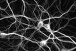 Image of a neuron, select to go to the MSc in Applied Neuropsychology page