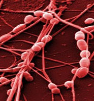 Streptococcus bacteria (red spheres in chains) adhering to collagen fibres