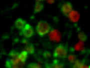 Atg4D (green) attached to mitochondria (red) in a cancer cell