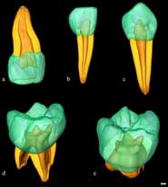 Virtual 3D reconstruction of four deciduous and one permanent teeth assessed for linear, surface, and volumetric tissue proportions