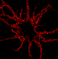 An image of a hippocampal neuron