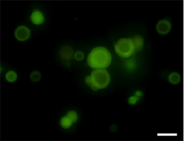 Fluorescence microscopy image of membrane-coated coacervate droplets
