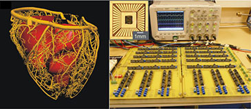 Image of a heart and pacemaker equipment