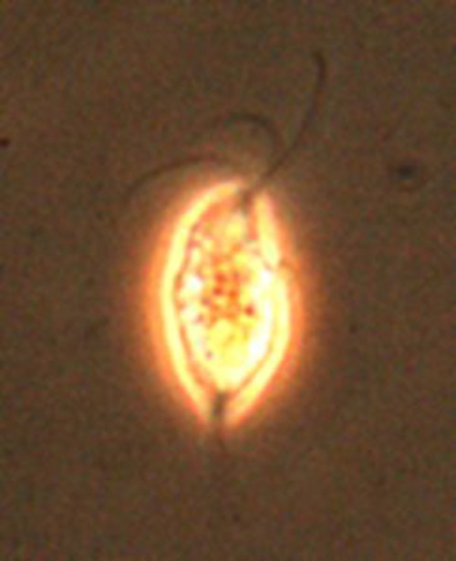 Image of Trichomonas vaginalis 