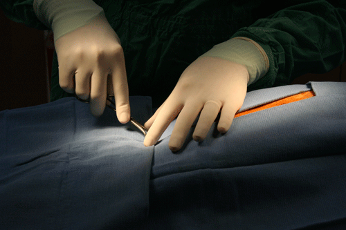 Generic image illustrating surgery