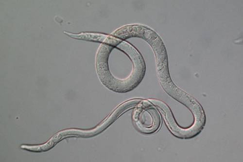Image of the parasitic worm Strongyloides 
