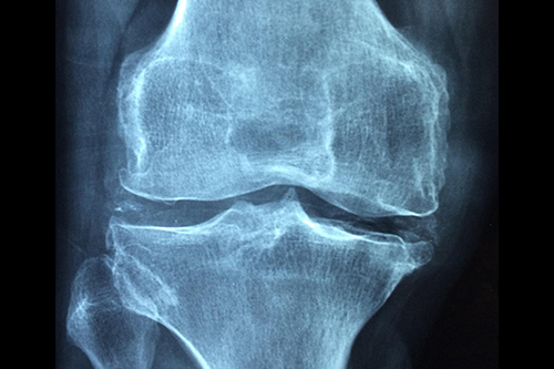 A knee x-ray