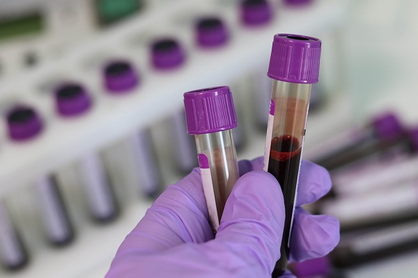 Blood test tubes in a laboratory