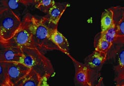 Invasion of cultured epithelial cells by Porphyromonas gingivalis