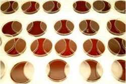 Blood agar plates