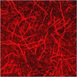 Biofilm growth of fungus Candida albicans