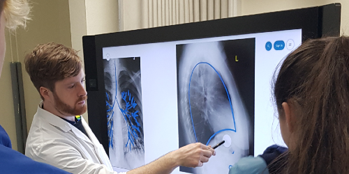 An anatomy lecturer is teaching a class and pointing to part of an x-ray of a human chest displayed on a large monitor. Select to go to the School of Anatomy 'Postgraduate programmes' page.