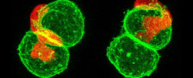 Leucocyte cancer cells
