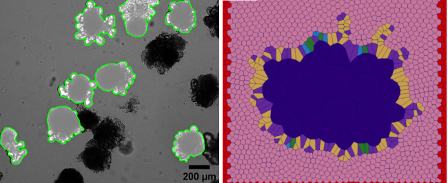 Modelling of intestinal organoids