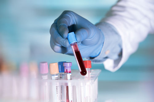 An image of someone holding a test tube of blood wearing a glove and lab coat 