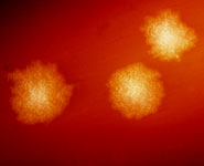 Clostridium difficile bacteria on a blood agar plate
