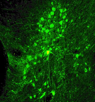 A single neuron (centre) in the perirhinal cortex which is involved in memory processes.