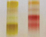 Stripes, by Lucy Crouch, Department of Biochemistry