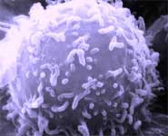 An electron microscopic image of a single human lymphocyte