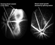 Images showing blood vessel growth in the retina (left image) and the blood vessel growth blocked by the splicing switch (right image)