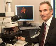 Seth Love, Professor of Neuropathology