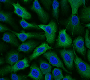 PRH in normal breast cells: green - PRH protein/blue - DNA