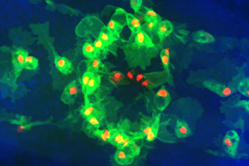 A confocal microscope image of immune cells (green) at a wound in a living Drosophila embryo one hour after wounding with an ablation laser.