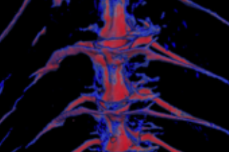 Visualisation of zebrafish muscle and bone using micro-CT and biorefringence microscopy - spine section