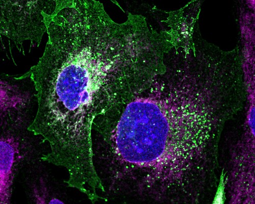 Image of patient derived podocyte kidney cells repaired with novel baculovirus-vectored approach pioneered by the Berger team. Podocin (coloured in green) is restored to the cell surface as in healthy podocytes.