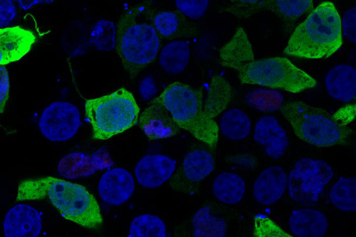 Microscopy image of cells - a mutated form of a protein called ERG, which is present in some lymphedema patients, is shown in green, while cell nuclei are shown in blue