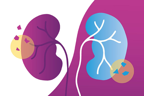 Kidney graphic