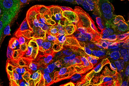 A 3D microscope image of healthy micro vessels in kidney tissue (specimen highlighting a glomerulus, one of millions of near identical filtering units within our kidneys). The sugars on the surface of the micro vessels and red blood cells (RBC) have both been labelled green, the underlying cell membranes have been labelled red and cell nuclei are blue.