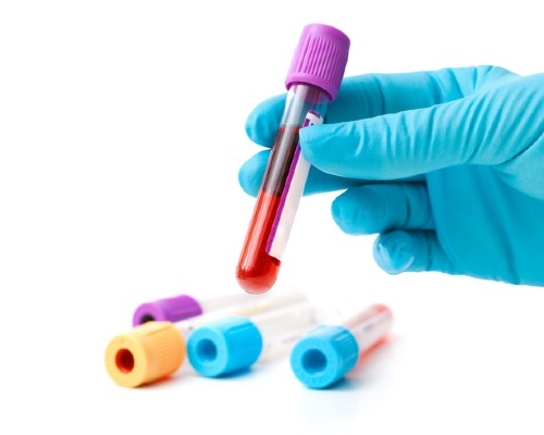 Hand in blue surgical glove holding a test tube with blood in it and some empty test tubes lying nearby