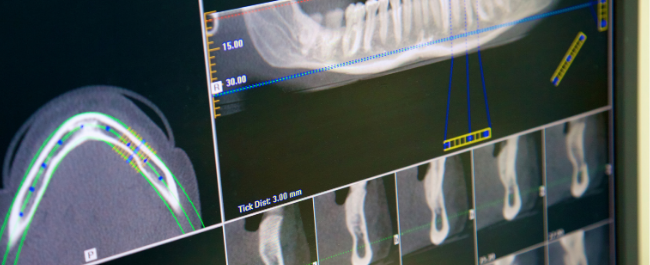 X-ray - a type of ionising radiation