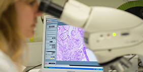 person looking down microscope at histology slide, slide is displayed on monitor beside microscope