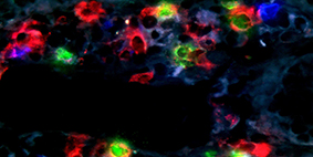 immunofluorescence cells