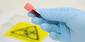 gloved hand holding blood sample tube