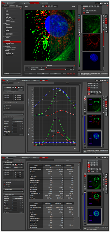 Leica LAS X | Wolfson Bioimaging Facility | University of Bristol