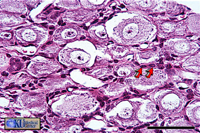 Dorsal Root Ganglion.   Bar is 50 microns