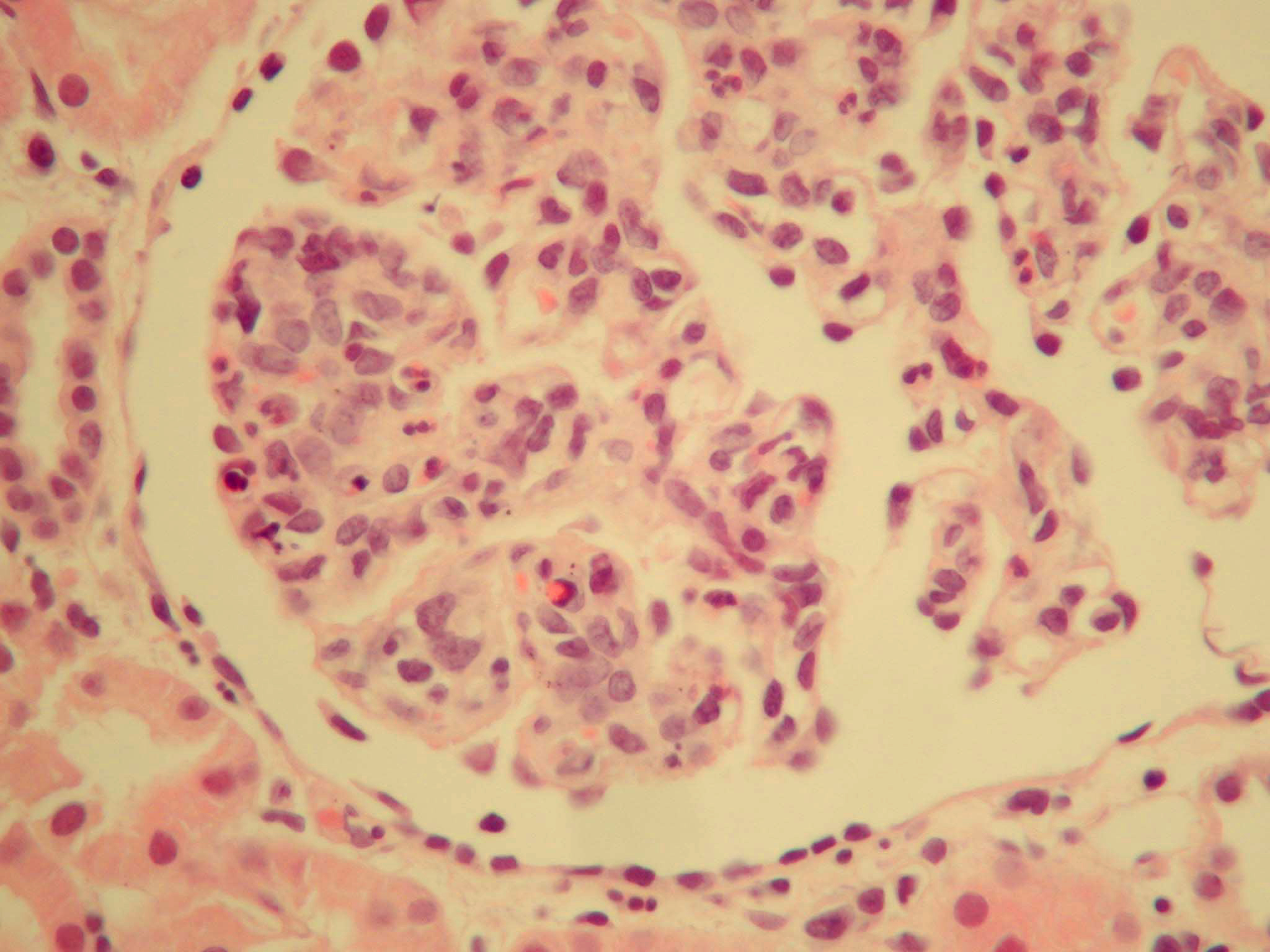 glomerulus